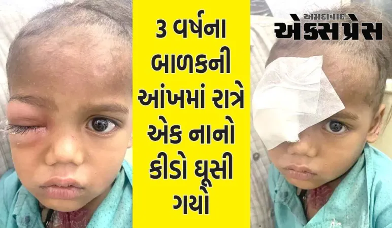 3 વર્ષના બાળકની આંખમાં નાનો કીડો ઘૂસી ગયો, ઓપરેશન બાદ જીવતો બહાર આવ્યો