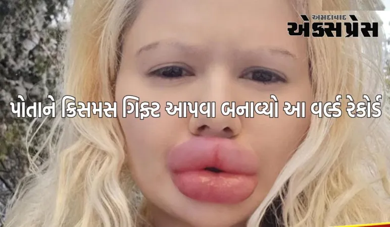 છોકરીએ ક્રિસમસ પર પોતાને ગિફ્ટ આપવા માટે પોતાના હોઠ જાડા કર્યા, બનાવ્યો આ વર્લ્ડ રેકોર્ડ