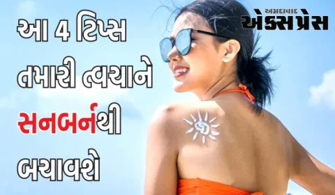 Sunburn: શું ઉનાળામાં તમને સનબર્નનો ડર સતાવે છે? તો આ 4 ટિપ્સ તમારી ત્વચાને બચાવશે