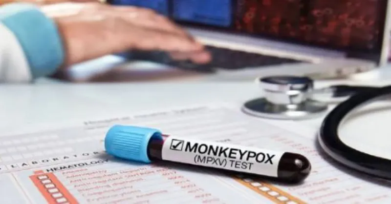 મંકીપોક્સ એલર્ટ વચ્ચે કેન્દ્રએ એરપોર્ટ્સ પર તકેદારી વધારી 