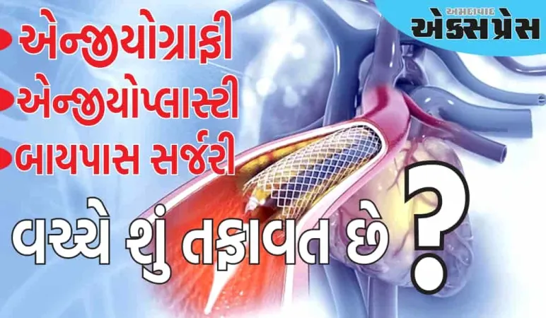 એન્જીયોગ્રાફી, એન્જીયોપ્લાસ્ટી અને બાયપાસ સર્જરી વચ્ચે શું તફાવત છે, સ્ટેન્ટ ક્યારે જરૂરી છે?