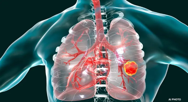 સિગારેટ ન પીવા છતાં ફેફસાંના કેન્સરનું જોખમ: જાણો કારણો અને બચાવ