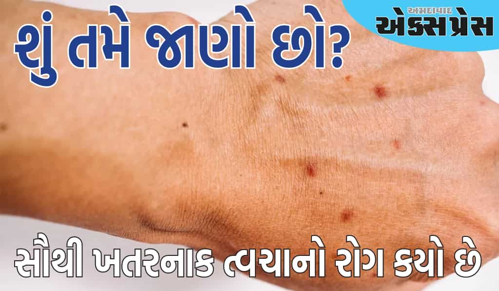 સૌથી ખતરનાક ત્વચાનો રોગ કયો છે અને તેના લક્ષણો શું છે?