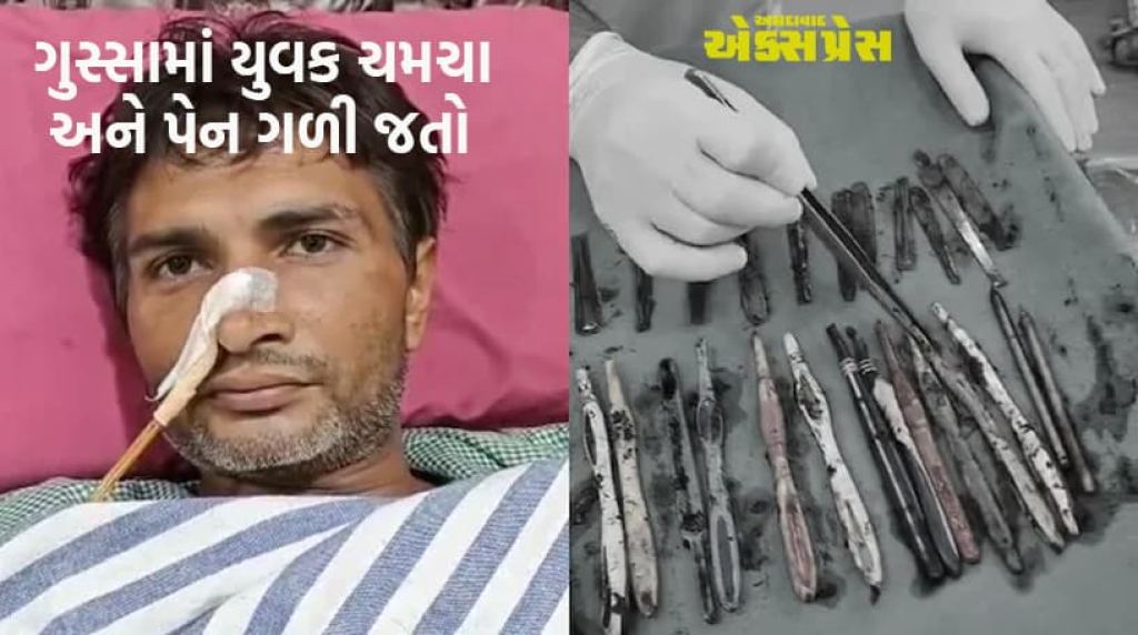 નશા મુક્તિ કેન્દ્રના દર્દીના પેટમાંથી નીકળ્યા 29 ચમચા અને 19 ટૂથબ્રશ!