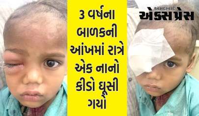 3 વર્ષના બાળકની આંખમાં નાનો કીડો ઘૂસી ગયો, ઓપરેશન બાદ જીવતો બહાર આવ્યો