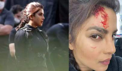 Priyanka Chopra Injured : પ્રિયંકાનું કપાળ લોહીથી લથપથ, દેશી ગર્લ કેવી રીતે ઘાયલ થઈ