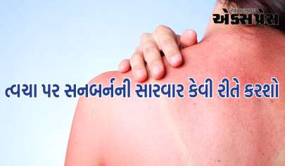 સૂર્યપ્રકાશને કારણે ત્વચા બળી જાય છે, આ ઉપાયો કરો તાત્કાલિક મળશે રાહત