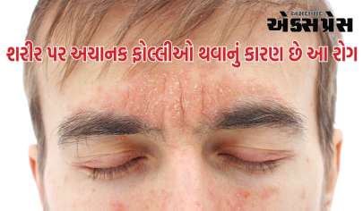 શરીર પર અચાનક ફોલ્લીઓ થવાનું કારણ છે આ રોગ, જાણો શું છે અને શા માટે થાય છે?