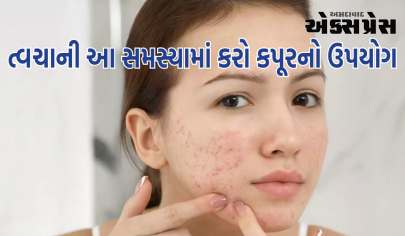 ત્વચાની આ સમસ્યામાં કરો કપૂરનો ઉપયોગ, જાણો રીત અને ફાયદા