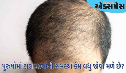 સ્ત્રીઓ કરતાં પુરુષોમાં ટાલ પડવાની સમસ્યા કેમ વધુ જોવા મળે છે? કારણ શું છે?